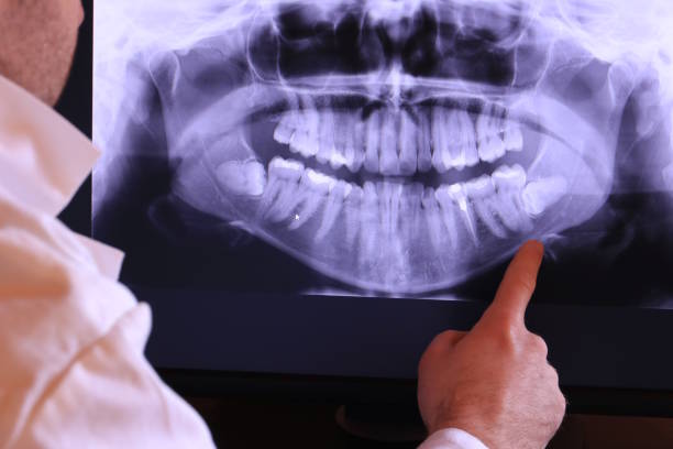 Best Emergency Tooth Extraction in Kittredge, CO