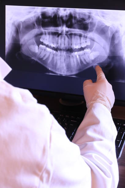 Best Emergency Broken Tooth Repair in Kittredge, CO