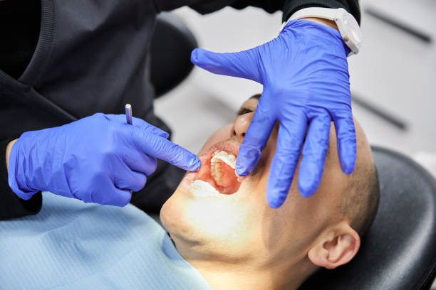 Best Emergency Tooth Extraction in Kittredge, CO